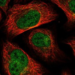 MTFMT Antibody, Novus Biologicals 0.1mL; Unlabeled:Antibodies, Polyclonal